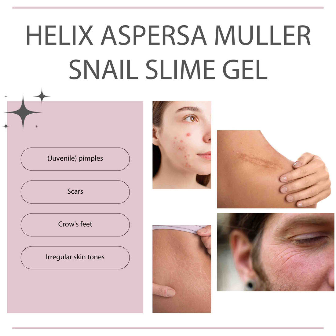 Camille-cosmetics-helix-aspersa-muller-slakkenslijmgel-snail-gel-schneckenschleimgel-gel-bave-escargot-goldlook-information